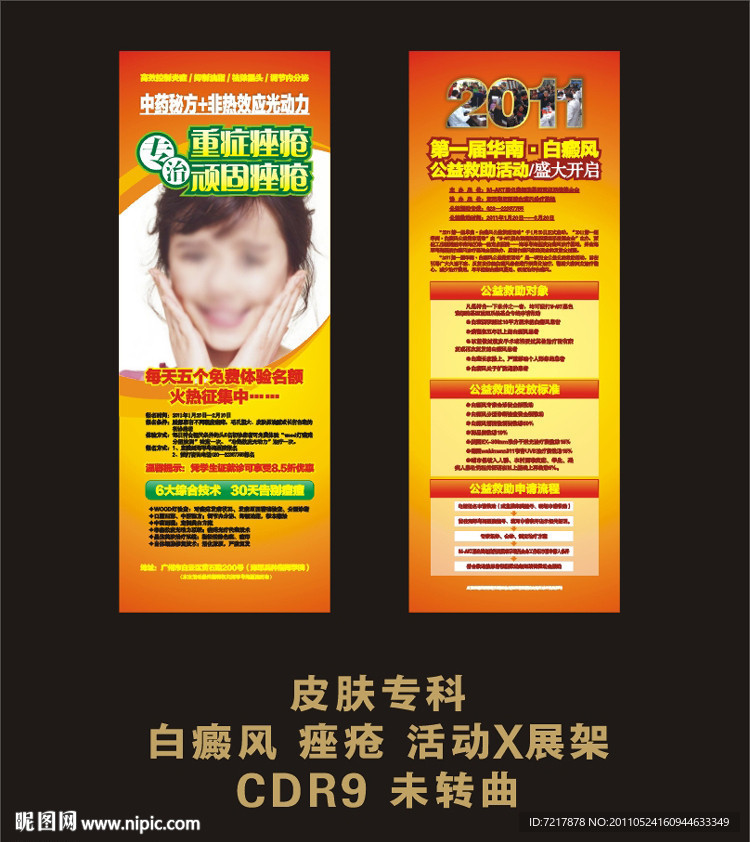 白癜风 痤疮 活动