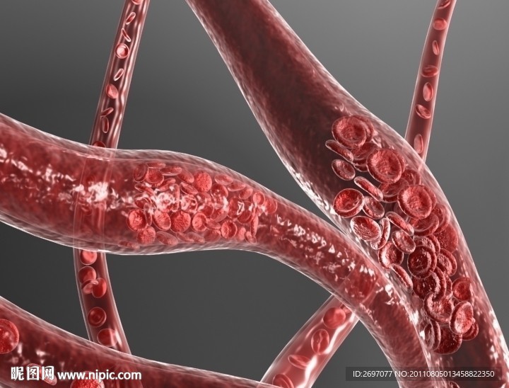 血管堵塞淤积动画