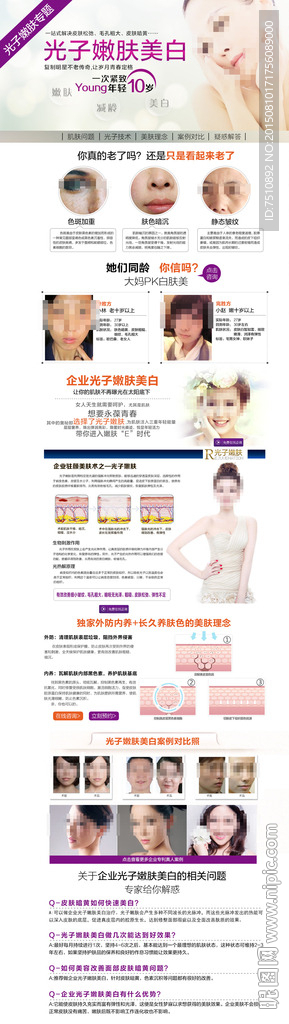 光子嫩肤