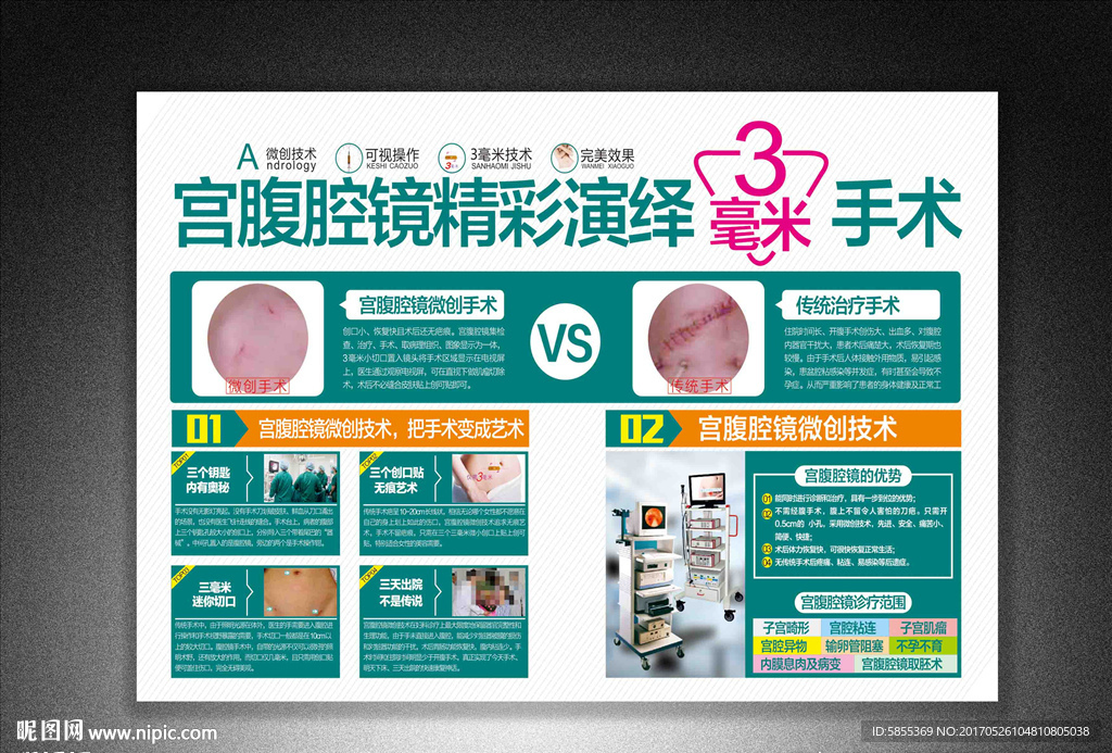 宫腹腔镜广告