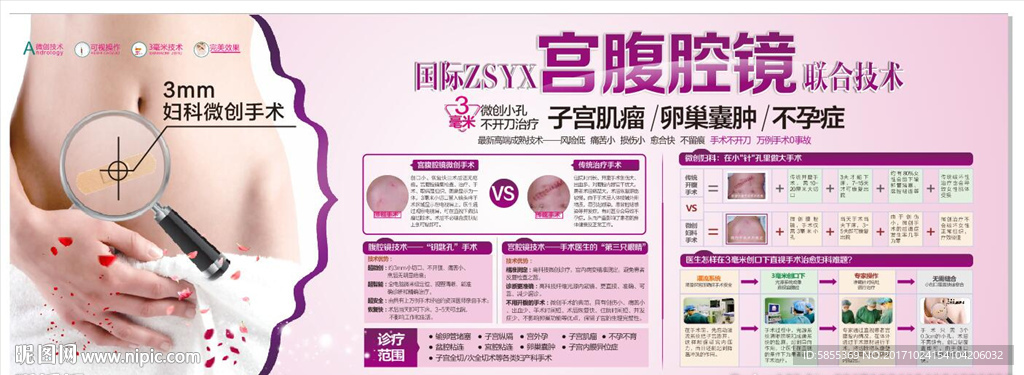 宫腹腔镜展板 宫腹腔镜
