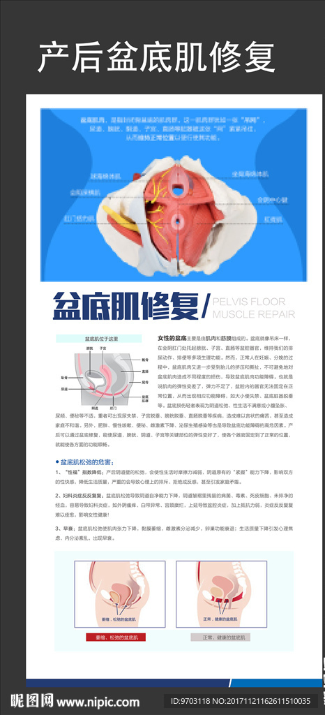 产后盆底肌修复