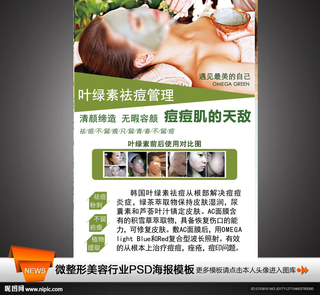 叶绿素焕肤 祛痘皮肤管理 排毒