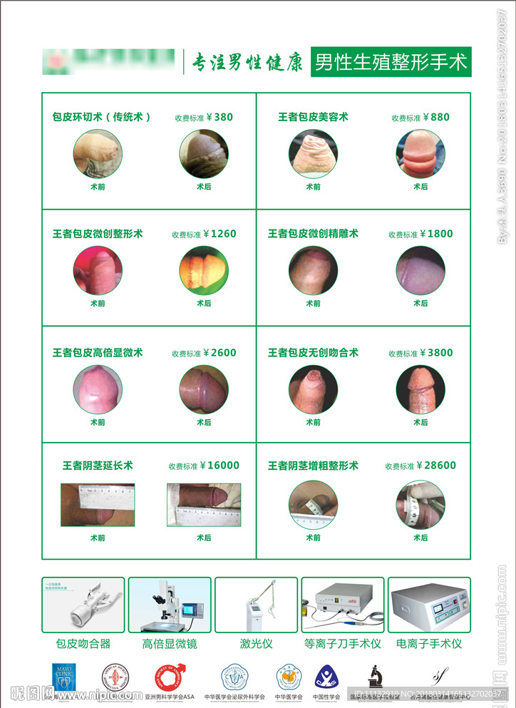 男科手术价格表