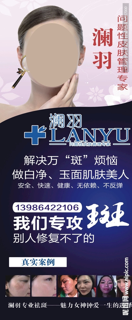 澜羽皮肤管理专家海报