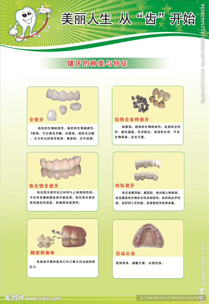 镶牙的种类和特征