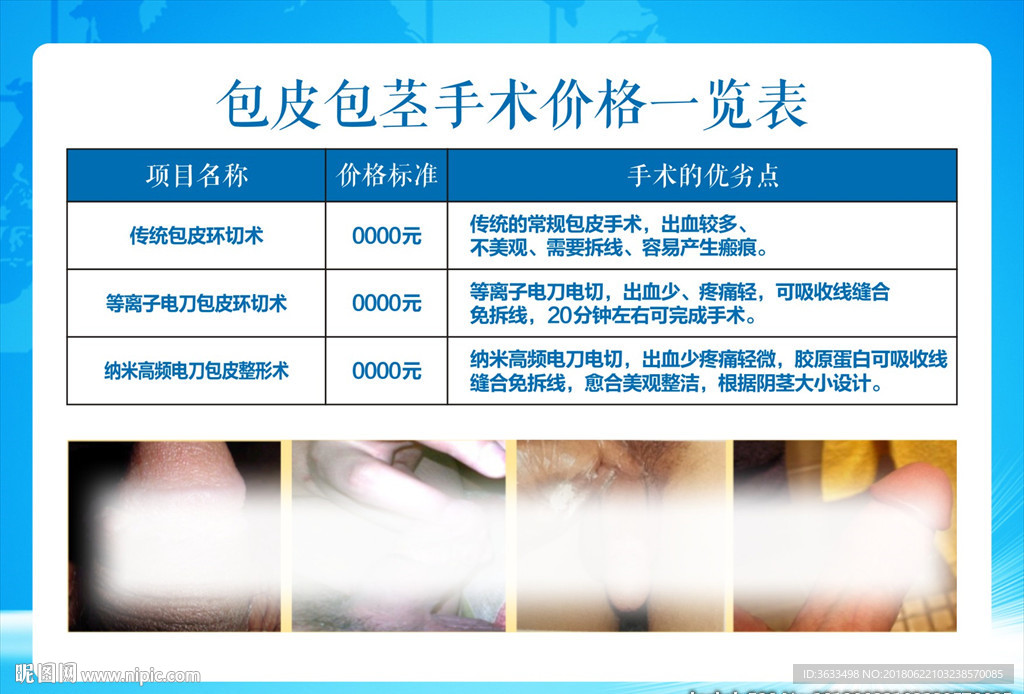 包皮手术分型，包皮手术价格