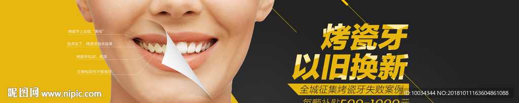 烤瓷牙专题banner