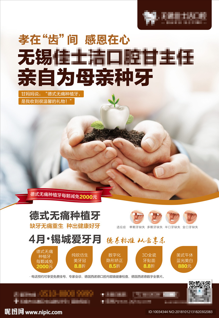 种植牙电梯框架