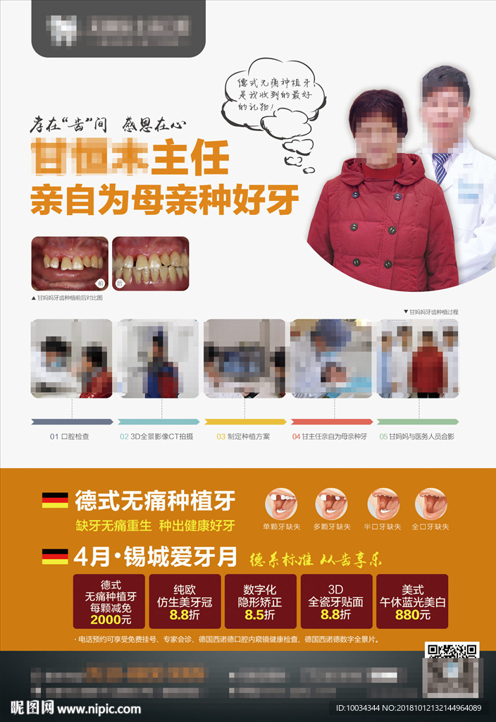 种植牙电梯框架