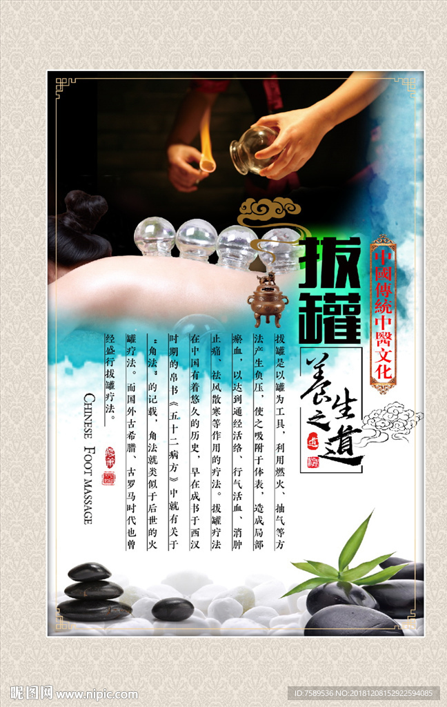 古典拔罐养生文化装饰画