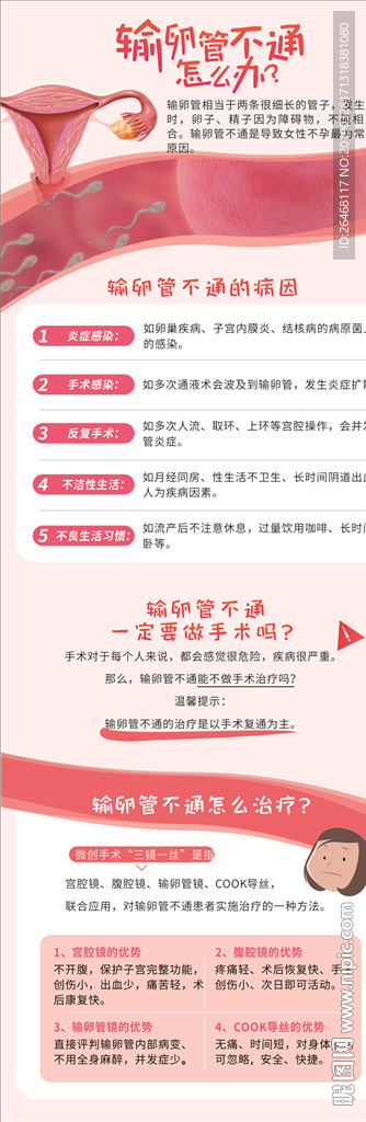 输卵管不通 百度营销页面