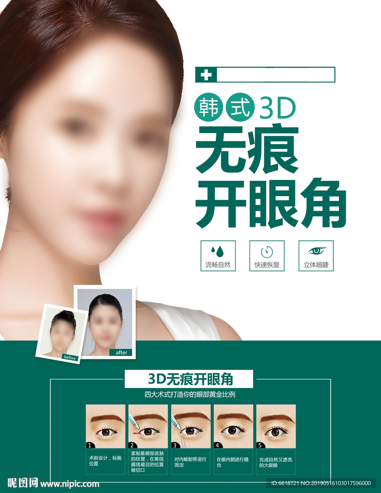 开眼角 整形美容 双眼皮