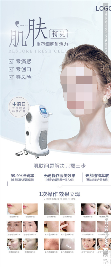 医美 美容 易拉宝 X展架