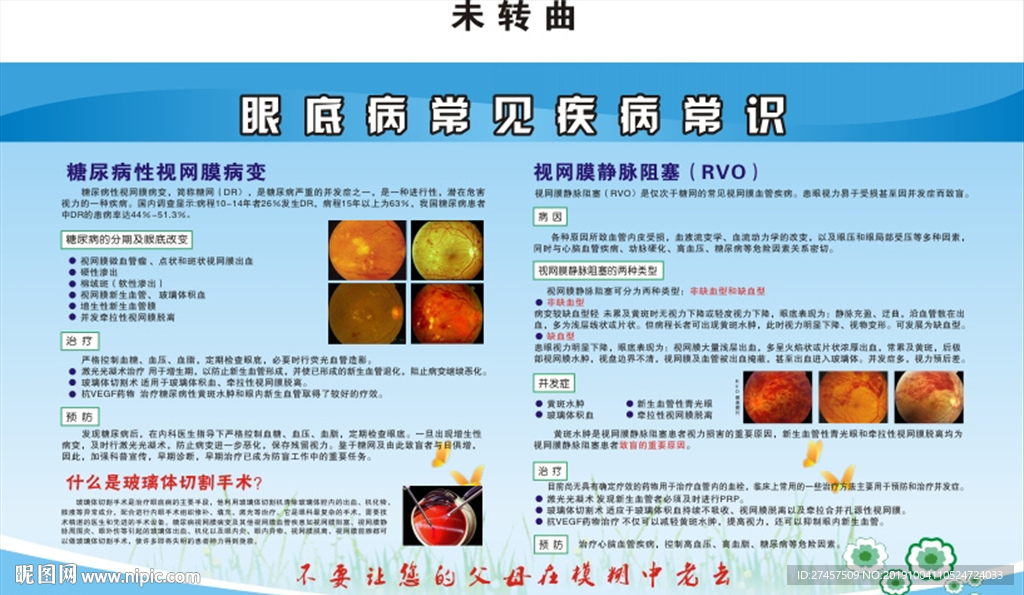 铭仁眼科眼底病常见疾病常识