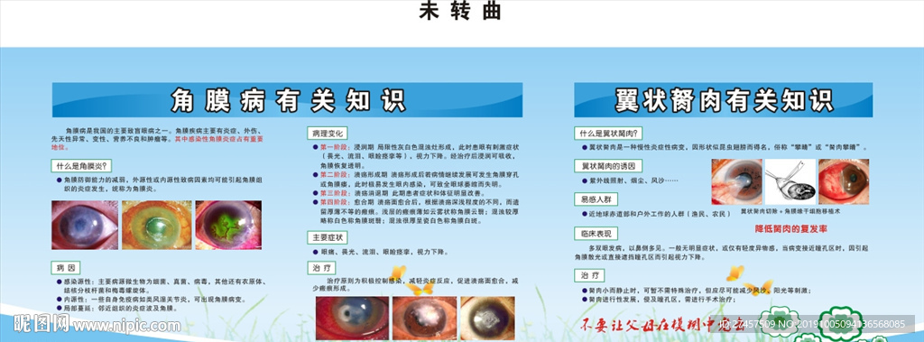 角膜病 翼状胬肉