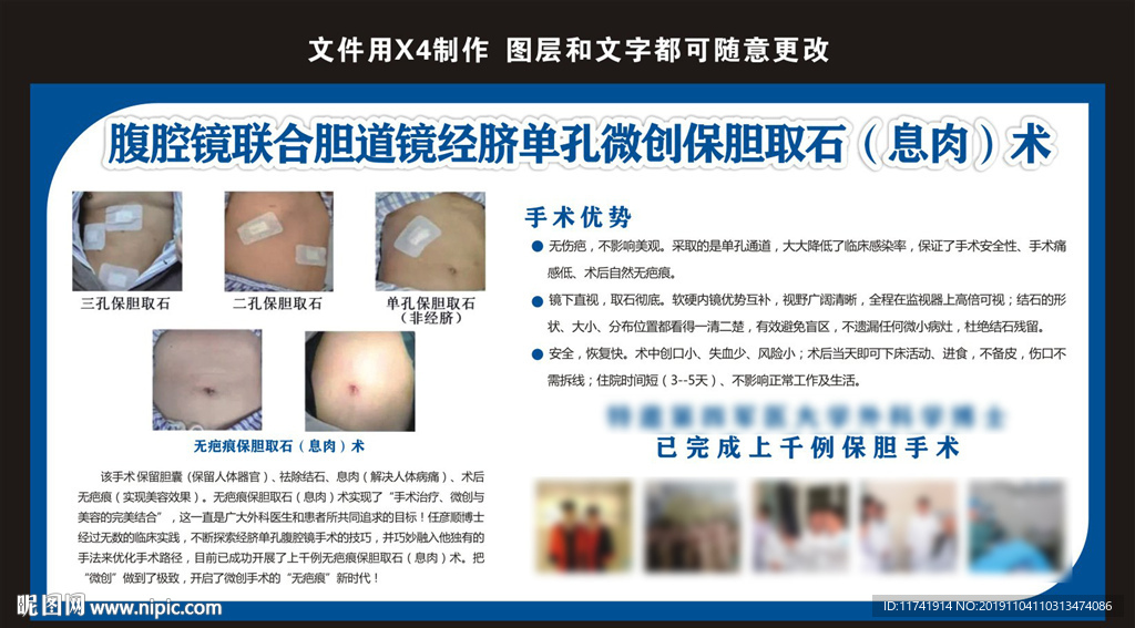 宫腹腔镜展板
