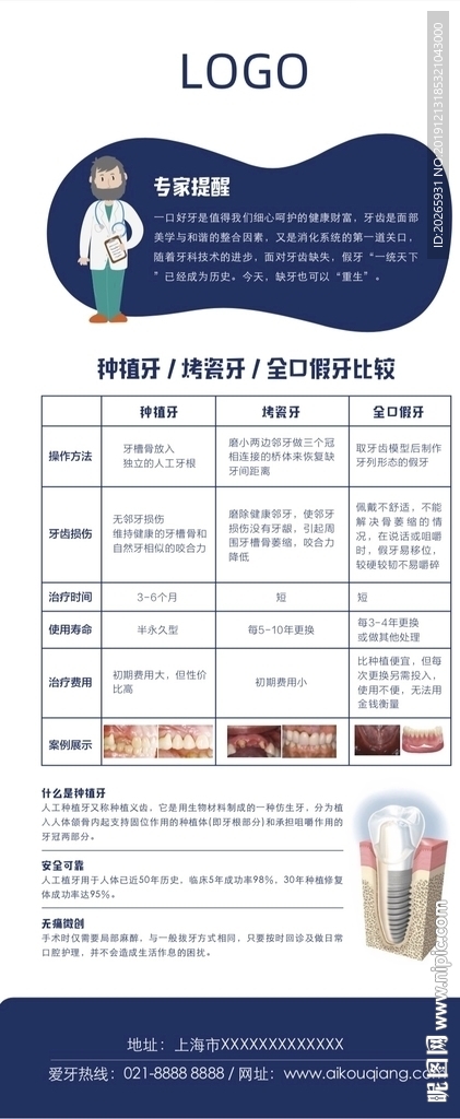 种植牙对比展架