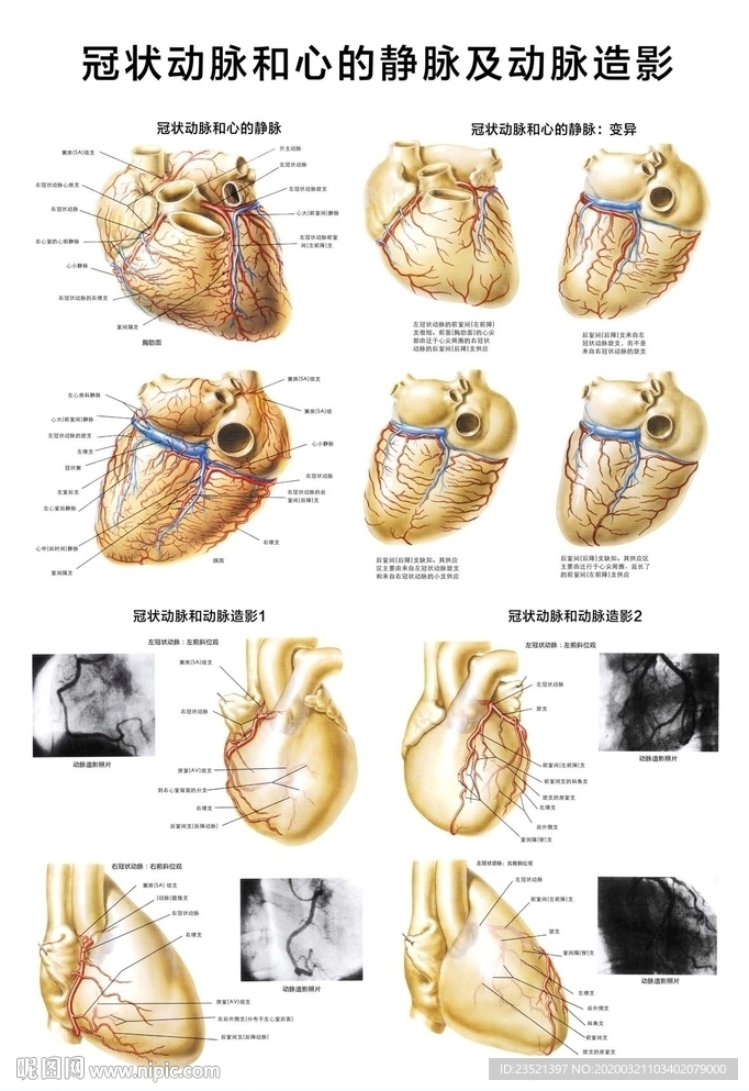 冠状动脉和心的静脉及动脉造影