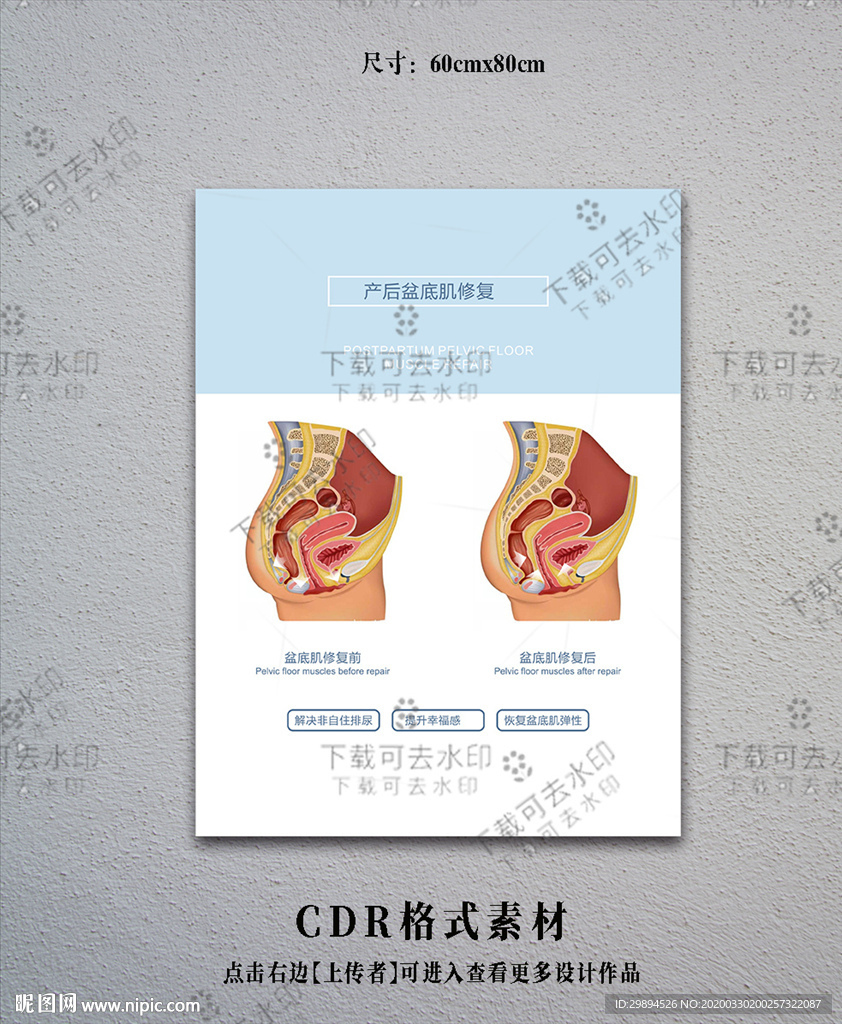 产后修复海报设计