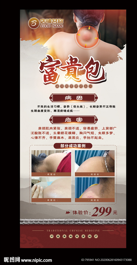 富贵包的病因和危害展架