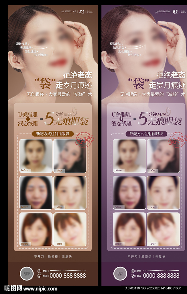 祛除眼袋 无痕眼袋