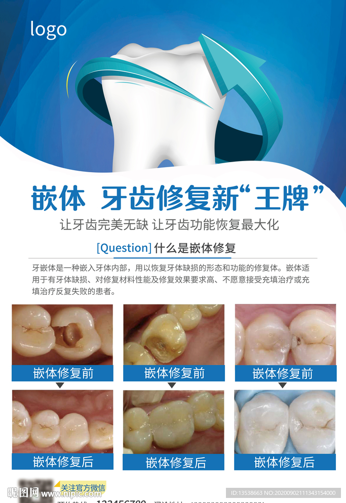 口腔海报 KT板 嵌体