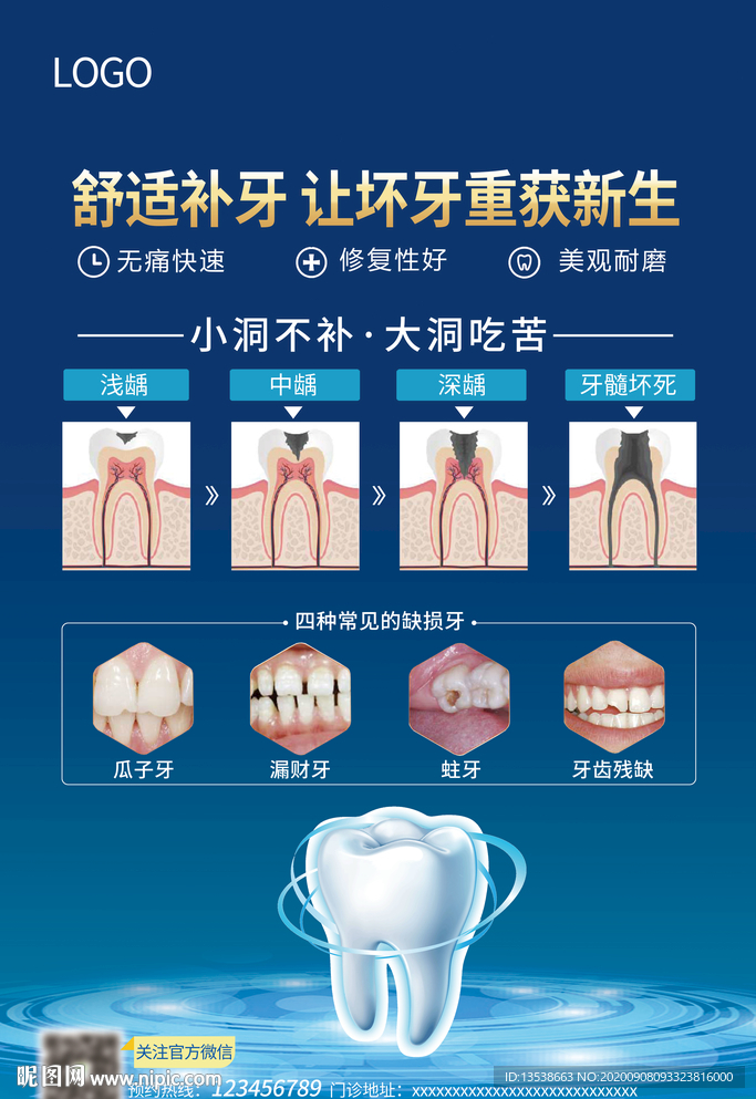 补牙KT板 牙科口腔海报