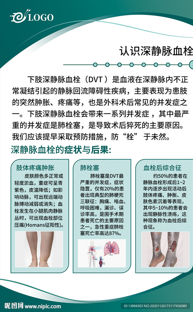 认识深静脉血栓