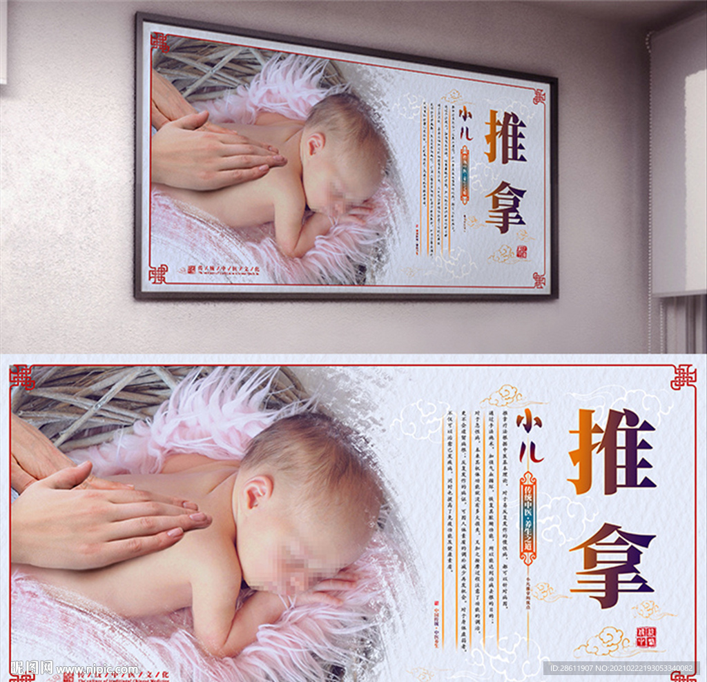 中式小儿推拿展板