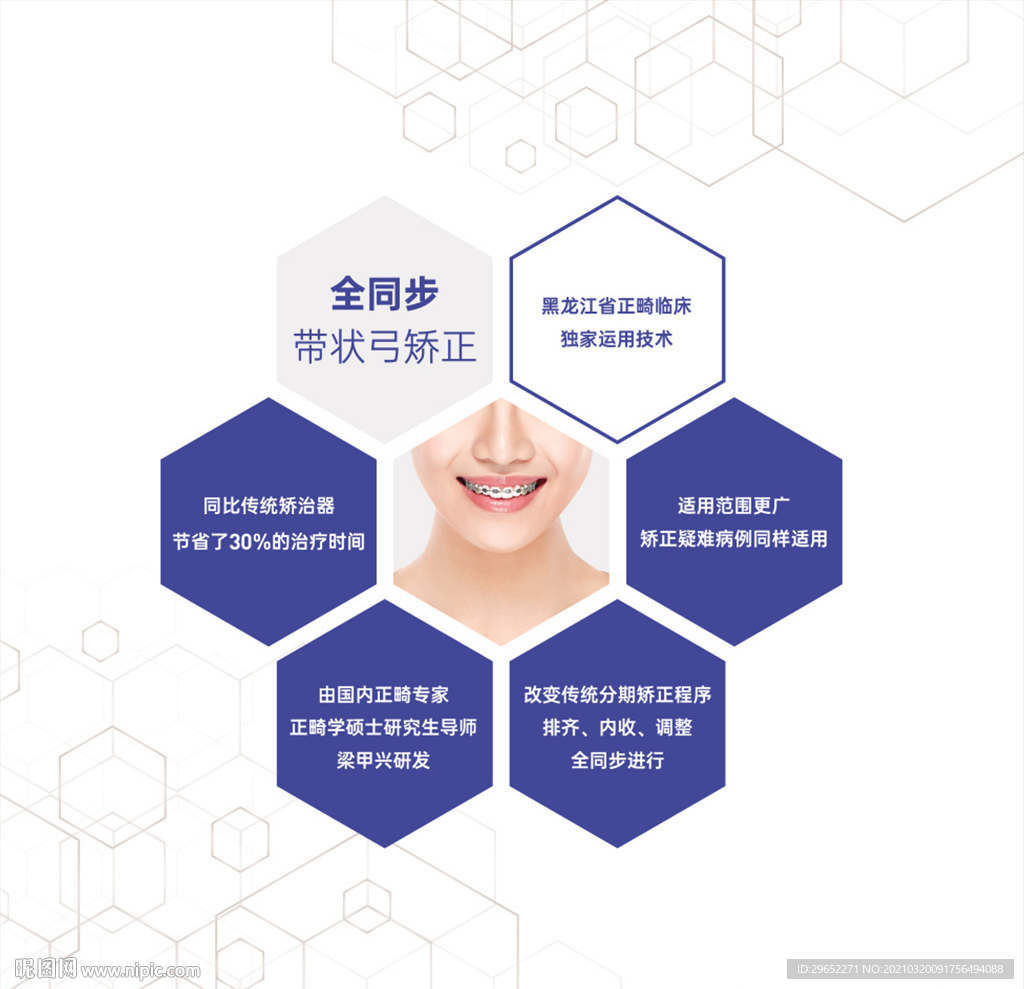 全同步带状弓牙齿矫正