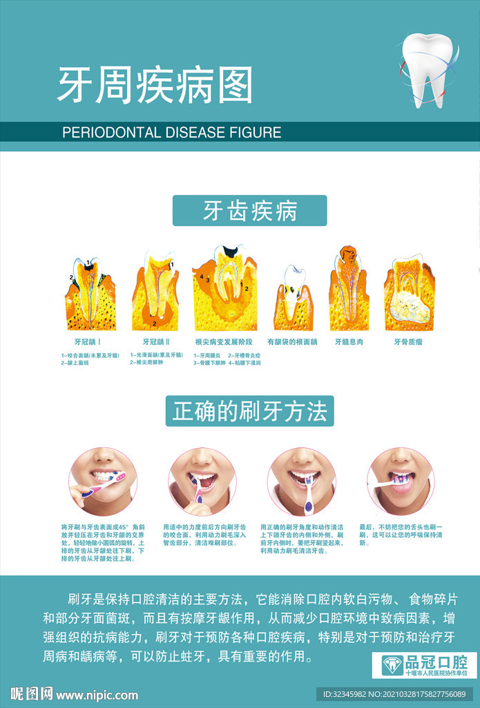 口腔医院挂图——牙周疾病图