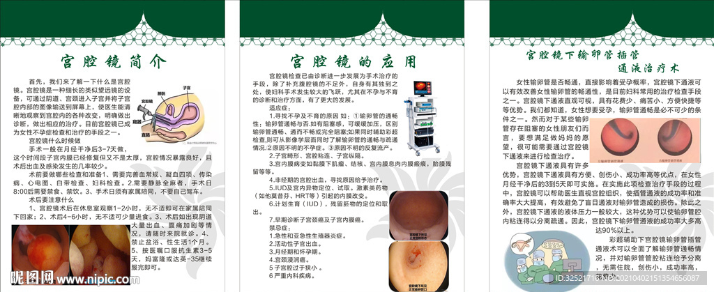 宫腔镜的介绍和应用