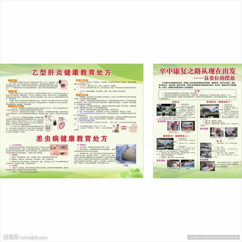 乙型肝炎  卒中康复