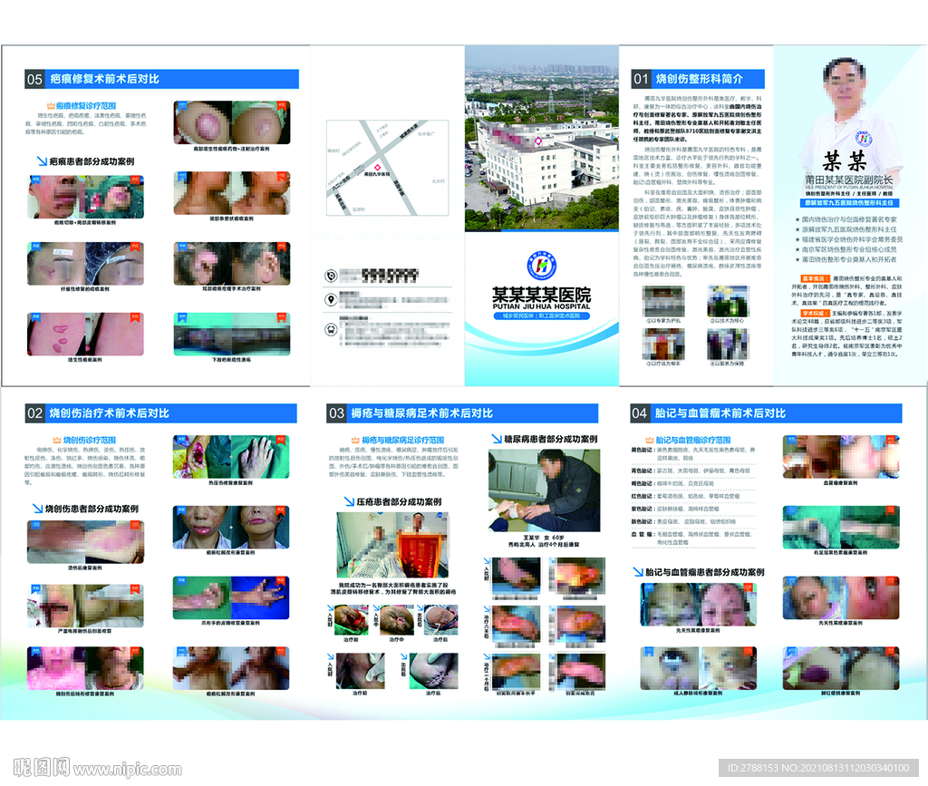 烧伤科折页 胎记