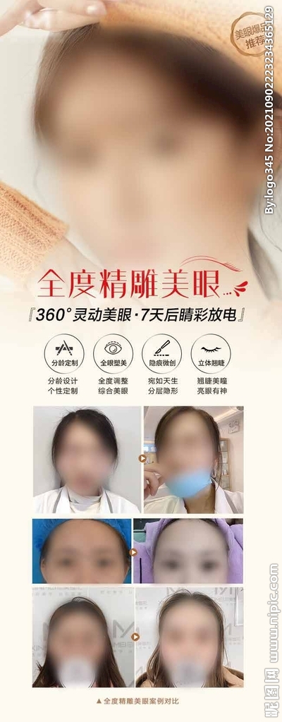 医美双眼皮宣传海报活动案例展架