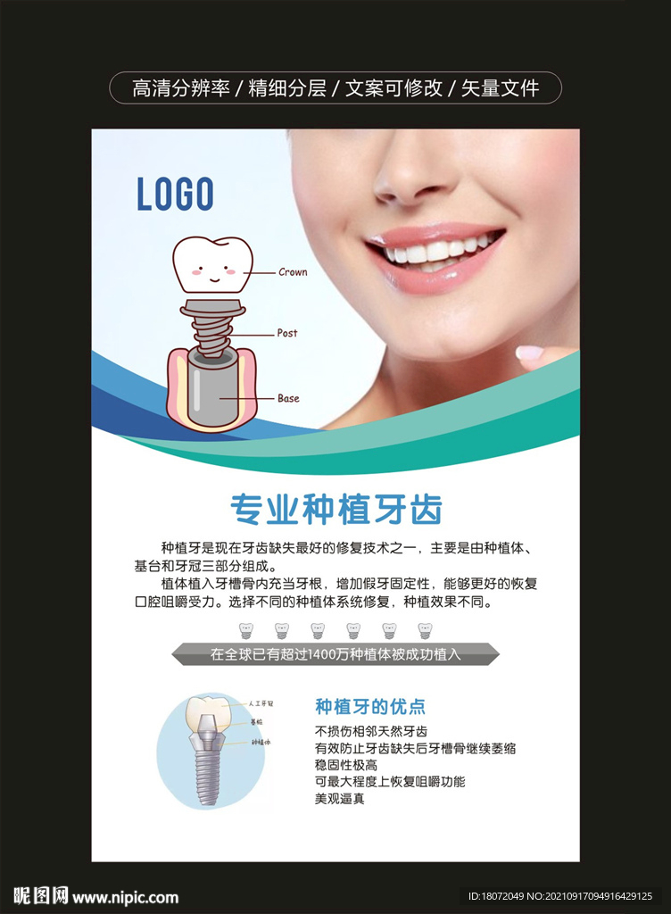 牙科海报 牙科广告 种植牙齿
