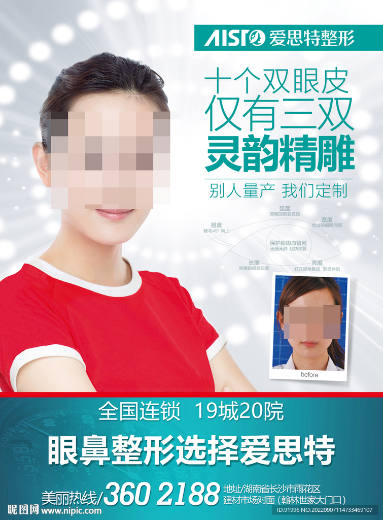 整形模特  眼部整形案例