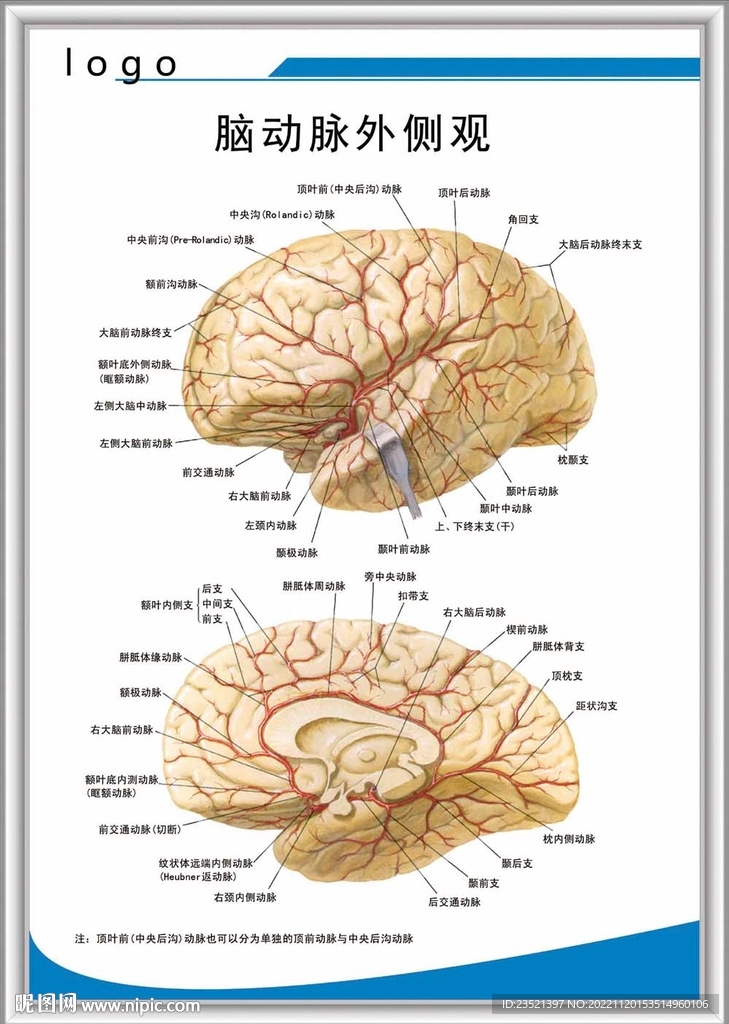 脑动脉外侧观解剖图