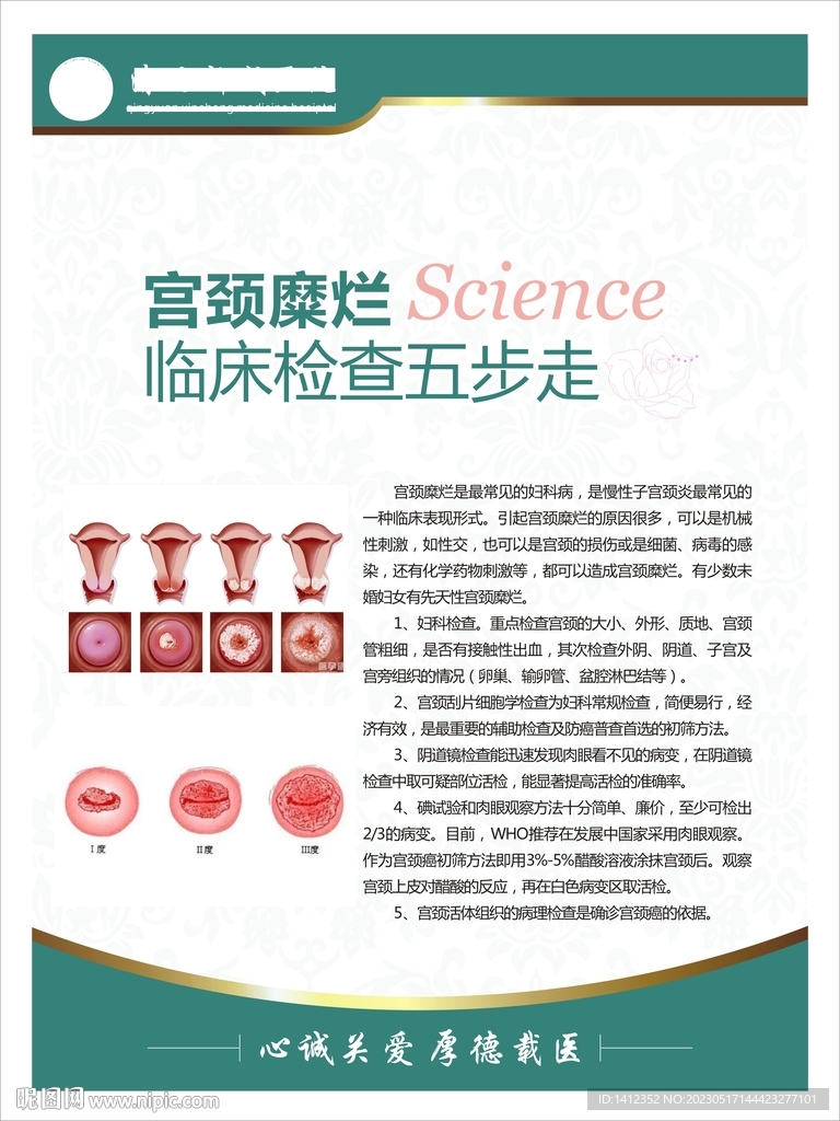 宫颈糜烂临床检查五步走