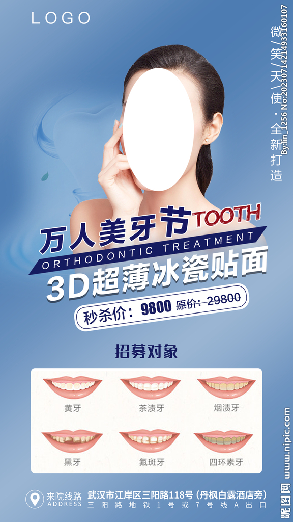 牙贴面海报