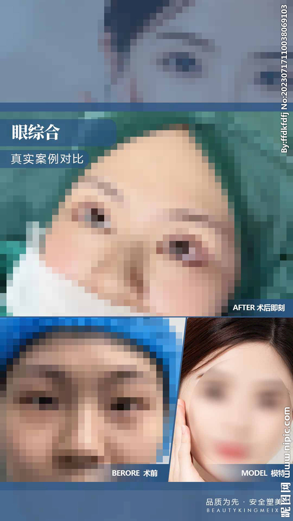 眼综合案例对比