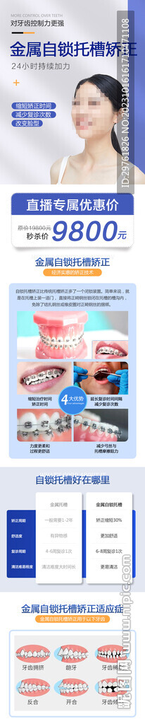 金属自锁托槽矫正