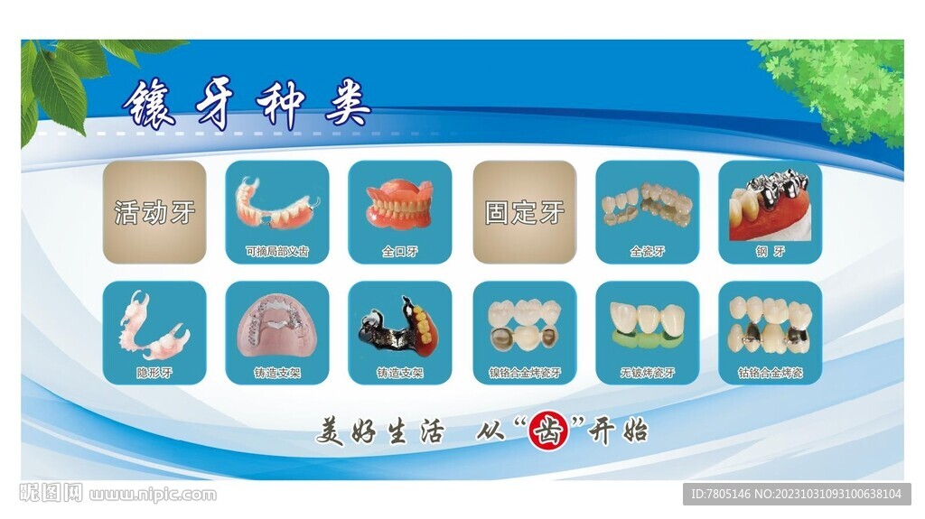 镶牙种类 
