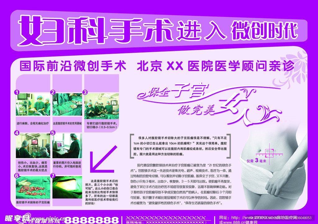 妇科展板