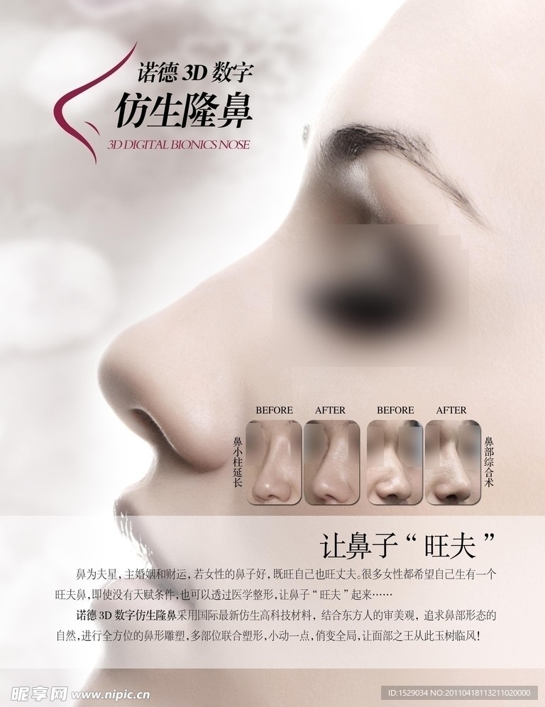 3D仿生隆鼻