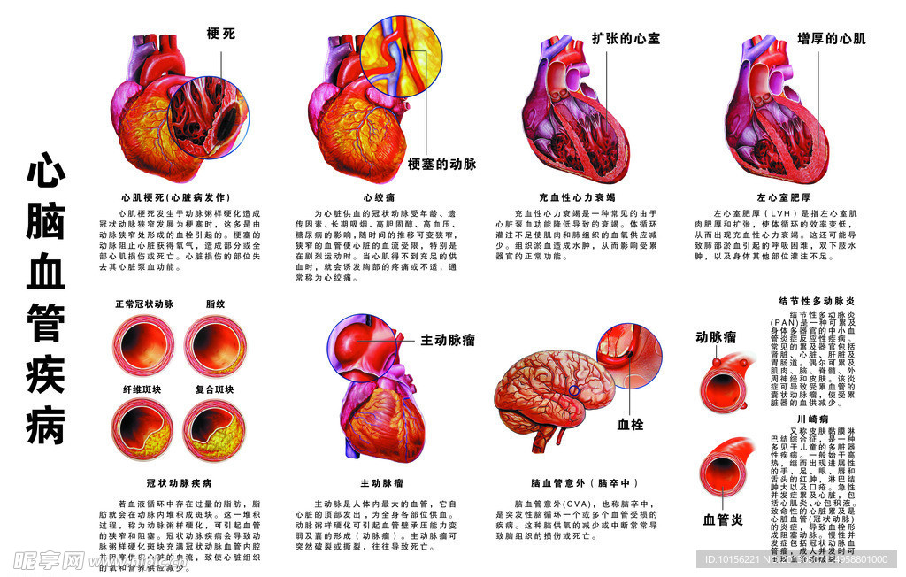 心脑血管疾病插图