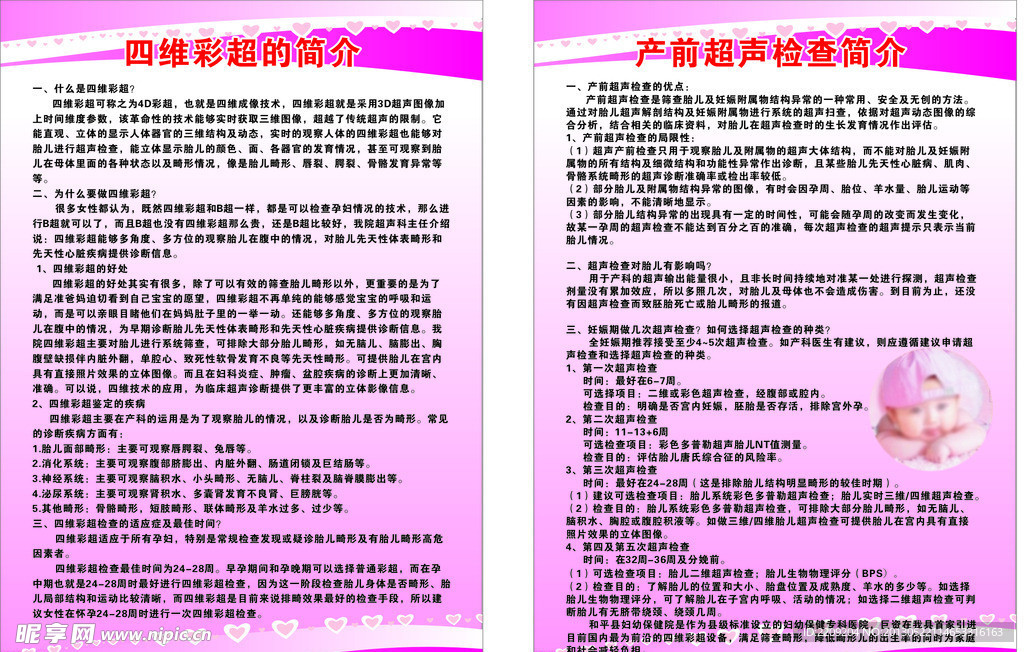 四维彩超 产前超声