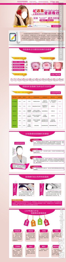 宫颈糜烂专题