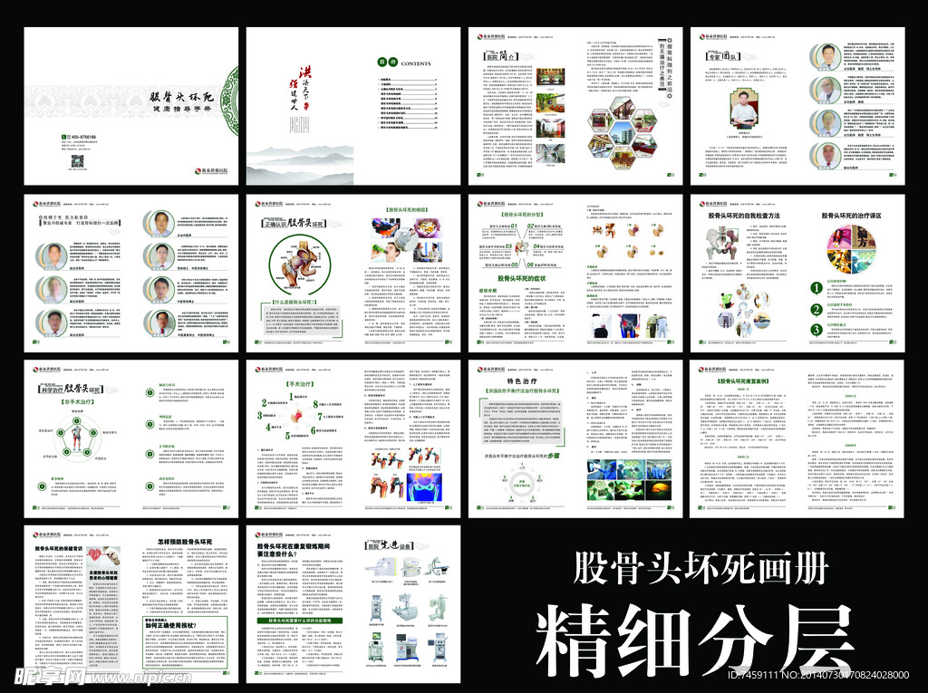 股骨头坏死画册